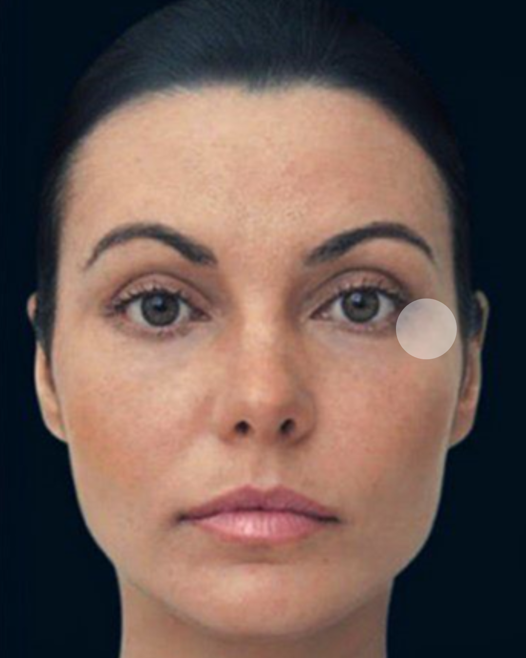 MNF metodo de naturalização facial em belo horizonte
