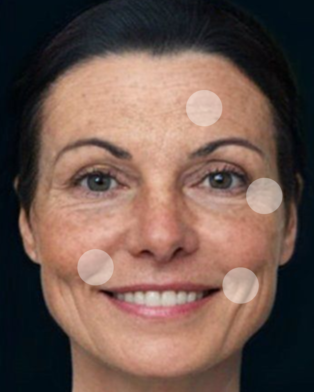 MNF metodo de naturalização facial em belo horizonte